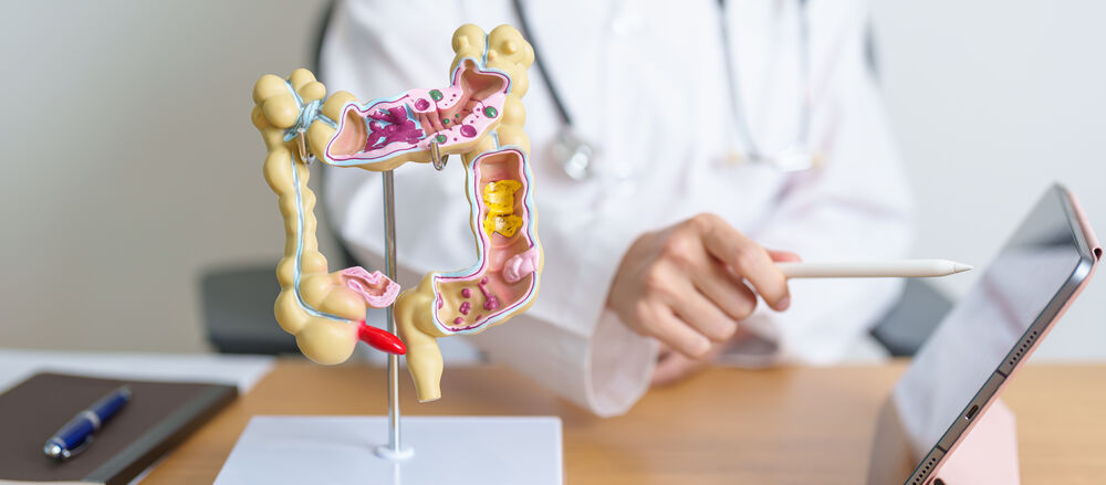 Modelo anatômico do intestino grosso humano.