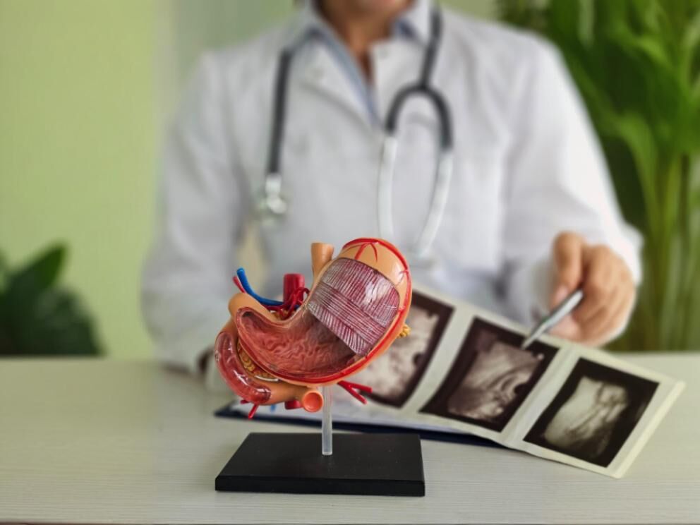 Modelo 3D do estômago com exames médicos ao fundo