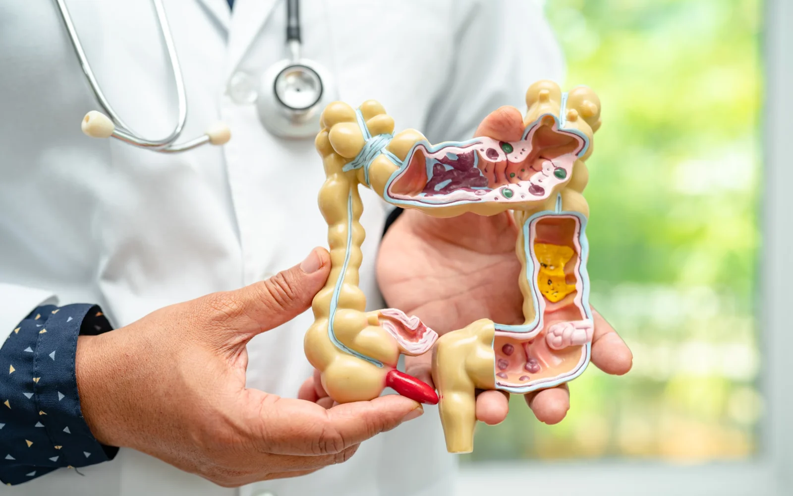 Protocolo Saúde Intestinal